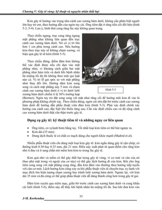 Chương V: Gây tê vùng: kỹ thuật và nguyên nhân thất bại

    Kim gây tê hướng vào trung tâm cành cao xương hàm dưới, không cần phân biệt người
lớn hay trẻ em, theo hướng dẫn của ngón tay cái. Ống tiêm đặt ở răng tiền cối đối bên (hình
5-3, 5-4). Lưu ý, hình thái cung răng lúc này không quan trọng.

    Theo chiều ngang, trục cung răng ngang
mặt phẳng nhai không liên quan đến trục
cành cao xương hàm dưới. Nó có vị trí lớn
hơn 1 cm phía trong cành cao. Nếu hướng
kim theo trục này sẽ không chạm xương, và
hiệu quả gây tê sẽ kém (hình 5-5).

   Theo chiều đứng, điểm đâm kim không
thể xác định được nếu chỉ dựa vào mặt
phẳng nhai, vì khoảng cách giữa hai mặt
phẳng nhai hàm trên và dưới khi bệnh nhân
há miệng tối đa thì không theo một qui luật
nào cả. Vị trí lỗ gai spix so với mặt phẳng
nhai thay đổi lớn. Hướng dâm kim song
song và cách mặt phẳng này 5 mm và chạm
cành cao xương hàm dưới ở vị trí dưới lưỡi                    Hình 5-5
xương hàm dưới chiếm tỉ lệ 36% trường hợp
(Bermer). Ngón tay trỏ đặt song song với mặt nhai răng cối để hướng mũi kim đi vào là
phương pháp không chính xác. Theo chiều đứng, ngón cái nên đặt bờ trước cành cao xương
hàm dưới để hướng dẫn phẫu thuật viên đâm kim (hình 5-3). Phải xác định chính xác
hướng của cành cao, đặc biệt khi thiếu răng sau; Cần xác định chiều cao và độ rộng cành
cao xương hàm dưới thật cẩn thận trước gây tê.

   Dụng cụ gây tê: kỹ thuật tiêm tê và những nguy cơ liên quan

   •   Ống tiêm, có xylanh bơm bằng tay. Tốt nhất loại kim tiêm có thể hút ngược ra.
   •   Kim dài (35 mm).
   •   Dung dịch thuốc tê có chất co mạch dùng cho người khỏe mạnh (Madrid et al).

   Nhiều phẫu thuật viên chỉ dùng một loại kim gây tê: kim ngắn dùng gây tê cận chóp, có
đường kính 0.30 hay 0.35 mm, dài 21 mm. Điều này xuất phát từ quan điểm cho rằng kim
nhỏ ít đau và ít sang chấn mô mềm hơn kim to trong lúc gây tê.

    Kim quá nhỏ và mềm có thể gây thất bại trong gây tê vùng, vì cơ mút và cân của nó
(bao phủ mặt trong và ngoài của cơ này) có thể gây lệch hướng đi của kim. Khi cho ống
tiêm song song với mặt phẳng cung răng, đầu kim đâm vào thường theo hướng tiếp tuyến
với cân cơ mút. Lệch hướng kim cũng xảy ra khi phẫu thuật viên di chuyển trục xy-lanh với
mục đích tìm hiện tượng chạm xương hay tránh lưỡi xương hàm dưới. Ngược lại, với kim
dài 35 mm và đủ cứng có thể giúp phẫu thuật viên dễ dàng thành công hơn trong gây tê gai.

    Đâm kim xuyên qua niêm mạc, giữa bờ trước cành cao xương hàm dưới và cung khẩu
cái lưỡi (hình 5-6), điểm này dễ thấy khi bệnh nhân há miệng tối đa. Sau khi đưa kim vào

                             33
J-M. Korbendau  ___________________________________
 