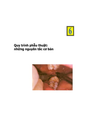 Quy trình phẫu thuật:
những nguyên tắc cơ bản
 