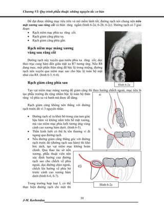 Chương VI: Quy trình phẫu thuật: những nguyên tắc cơ bản

   Để đạt được những mục tiêu trên và mô mềm lành tốt, đường rạch nói chung nên trên
mặt xương sau răng cối và thân răng ngầm (hình 6-2a; 6-2b; 6-2c). Đường rạch có 3 giai
đoạn:
   • Rạch niêm mạc phía xa răng cối.
   • Rạch giảm căng phía xa.
   • Rạch giảm căng phía gần.

   Rạch niêm mạc màng xương
   vùng sau răng cối
    Đường rạch này xuyên qua nướu phía xa răng cối; dọc
theo trục cung hàm đến giữa mặt xa R7 tương ứng. Nếu R8
đang mọc, một phần thân răng đã bộc lộ trong miệng, đường
rạch nên xuyên qua niêm mạc sao cho bộc lộ toàn bộ mặt
nhai của R8. (hình 6-3; 6-4).

   Rạch giảm căng phía sau
                                                                     Hình 6-2a
    Tạo vạt niêm mạc màng xương để giảm căng thì theo hướng chếch ngoài, mục tiêu là
tạo phẫu trường đủ rộng nhằm bộc lộ toàn bộ thân
răng về phía xa và banh má được dễ dàng.

    Rạch giảm căng không nên thẳng với đường
rạch trước đó vì 3 nguyên nhân:

   •   Đường rạch sẽ ra khỏi bờ trong của tam giác
       hậu hàm và không nằm trên bề mặt xương,
       mà vào niêm mạc phía lưỡi tương ứng vùng
       cành cao xương hàm dưới. (hình 6-5).
   •   Thần kinh lưỡi có thể bị tổn thương vì đi
       ngang qua đường rạch.
   •   Nếu đường giảm căng thẳng góc với đường
       rạch trước đó (đường rạch sau hàm) thì khó
       bóc tách, tạo vạt niêm mạc không hoàn
       chỉnh. Qua thao tác sờ nền
       xương, phẫu thuật viên nên                               Hình 6-2b
       xác định hướng của đường
       rạch sao cho chếch về phía
       ngoài, dọc đường chéo ngoài,
       chếch lên hướng về phía bờ
       trước cành cao xương hàm
       dưới (hình 6-6, 6-7).

   Trong trường hợp loại I, có thể                     Hình 6-2c
thực hiện đường rạch chỉ một thì


                             39
J-M. Korbendau  ___________________________________
 