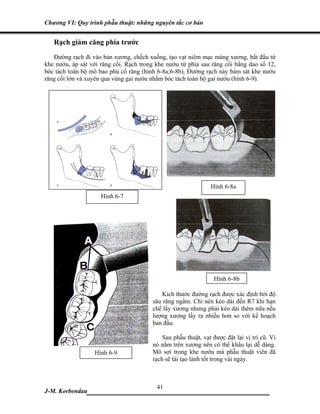 Chương VI: Quy trình phẫu thuật: những nguyên tắc cơ bản


   Rạch giảm căng phía trước
   Đường rạch đi vào bản xương, chếch xuống, tạo vạt niêm mạc màng xương, bắt đầu từ
khe nướu, áp sát với răng cối. Rạch trong khe nướu từ phía sau răng cối bằng dao số 12,
bóc tách toàn bộ mô bao phủ cổ răng (hình 6-8a;6-8b). Đường rạch này bám sát khe nướu
răng cối lớn và xuyên qua vùng gai nướu nhằm bóc tách toàn bộ gai nướu (hình 6-9).




                                                               Hình 6-8a
                     Hình 6-7




                                                                Hình 6-8b

                                            Kích thước đường rạch được xác định bởi độ
                                        sâu răng ngầm. Chỉ nên kéo dài đến R7 khi hạn
                                        chế lấy xương nhưng phải kéo dài thêm nữa nếu
                                        lượng xương lấy ra nhiều hơn so với kế hoạch
                                        ban đầu.

                                            Sau phẫu thuật, vạt được đặt lại vị trí cũ. Vì
                                        nó nằm trên xương nên có thể khâu lại dễ dàng.
                  Hình 6-9              Mô sợi trong khe nướu mà phẫu thuật viên đã
                                        rạch sẽ tái tạo lành tốt trong vài ngày.



                             41
J-M. Korbendau  ___________________________________
 