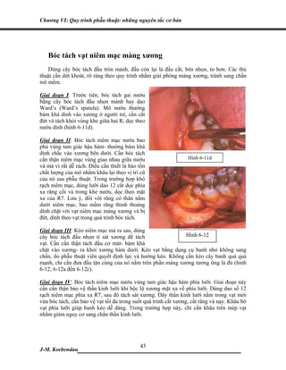 Chương VI: Quy trình phẫu thuật: những nguyên tắc cơ bản




   Bóc tách vạt niêm mạc màng xương
   Dùng cây bóc tách đầu tròn mảnh, đầu còn lại là đầu cắt, bén nhọn, to hơn. Các thủ
thuật cần dứt khoát, rõ ràng theo quy trình nhằm giải phóng màng xương, tránh sang chấn
mô mềm.

Giai đoạn I: Trước tiên, bóc tách gai nướu
bằng cây bóc tách đầu nhọn mảnh hay dao
Ward’s (Ward’s spatula). Mô nướu thường
bám khá dính vào xương ở người trẻ, cần cắt
đứt và tách khỏi vùng khe giữa hai R, dọc theo
nướu dính (hình 6-11d).

Giai đoạn II: Bóc tách niêm mạc nướu bao
phủ vùng tam giác hậu hàm- thường bám khá
dính chắc vào xương bên dưới. Cần bóc tách
cẩn thận niêm mạc vùng giao nhau giữa nướu                        Hình 6-11d
và má vì rất dễ rách. Điều cần thiết là bảo tồn
chất lượng của mô nhằm khâu lại theo vị trí cũ
của nó sau phẫu thuật. Trong trường hợp khó
rạch niêm mạc, dùng lưỡi dao 12 cắt dọc phía
xa răng cối và trong khe nướu, dọc theo mặt
xa của R7. Lưu ý, đối với răng có thân nằm
dưới niêm mạc, bao mầm răng thỉnh thoảng
dính chặt với vạt niêm mạc màng xương và bị
đứt, dính theo vạt trong quá trình bóc tách.

Giai đoạn III: Kéo niêm mạc má ra sau, dùng
cây bóc tách đầu nhọn tì sát xương để tách                  Hình 6-12
vạt. Cần cẩn thận tách đầu cơ mút- bám khá
chặt vào xương- ra khỏi xương hàm dưới. Kéo vạt bằng dụng cụ banh nhỏ không sang
chấn, do phẫu thuật viên quyết định lực và hướng kéo. Không cần kéo cây banh quá quá
mạnh, chỉ cần đưa đầu tận cùng của nó nằm trên phần màng xương tương ứng là đủ (hình
6-12; 6-12a đến 6-12c).

Giai đoạn IV: Bóc tách niêm mạc nướu vùng tam giác hậu hàm phía lưỡi. Giai đoạn này
cần cẩn thận bảo vệ thần kinh lưỡi khi bộc lộ xương mặt xa về phía lưỡi. Dùng dao số 12
rạch niêm mạc phía xa R7, sau đó tách sát xương. Dây thần kinh lưỡi nằm trong vạt mới
vừa bóc tách, cần bảo vệ vạt tối đa trong suốt quá trình cắt xương, cắt răng và nạy. Khâu bờ
vạt phía lưỡi giúp banh kéo dễ dàng. Trong trường hợp này, chỉ cần khâu trên mép vạt
nhằm giảm nguy cơ sang chấn thần kinh lưỡi.




                              43
J-M. Korbendau   ___________________________________
 