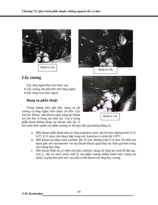 Chương VI: Quy trình phẫu thuật: những nguyên tắc cơ bản




              Hình 6-12a
                                                            Hình 6-12b

Lấy xương
   Lấy răng ngầm theo hai bước sau:
 • Lấy xương che phủ bên trên răng ngầm.
 • Lấy răng ra từ phía ngoài.

   Dụng cụ phẫu thuật
    Trong những năm gần đây, dụng cụ cắt
xương và răng ngầm luôn được cải tiến. Các
loại tay khoan, mũi khoan ngày càng tạo thuận                 Hình 6-12c
lợi cho bác sĩ trong các thao tác. Lưu ý trong
phẫu thuật không dùng tay khoan siêu tốc vì
hơi nước thổi mạnh vào phẫu trường có thể gây hậu quả không đáng có.

       a. Mũi khoan phẫu thuật tròn có răng (stainless steel: dài 64 mm; đường kính 0.23,
          0.27, 0.31 mm), nên được hấp trong nồi Autoclave ở nhiệt độ 1300C.
       b. Mũi khoan trụ nhọn (mũi carbide: dài 25 mm, đường kính 0.16 mm, tốt nhất nên
          được gắn vào micromotor với tay khoan khuỷu giúp thao tác hiệu quả hơn trong
          cắt xương hay răng.
       c. Mũi khoan hình trụ có rãnh cắt (mũi carbide), dùng cắt răng tạo rãnh để đặt nạy.
          Lưu ý, cần xịt nước muối sinh lý vào phẫu trường nhằm tránh hiện tượng tỏa
          nhiệt và giúp rữa sạch mô vụn sinh ra khi khoan cắt răng hay xương.




                             44
J-M. Korbendau  ___________________________________
 