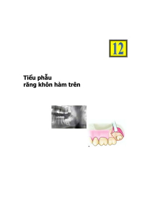 T i ể u p hẫ u
răng khôn hàm trên
 