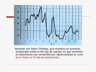 Paciente con fiebre Tifoidea, que muestra un aumento  escalonado hasta el 4to día de ingreso en que comenzó  el tratamiento con cloramfenicol; observándose la  caída  de la fiebre al 5º día de tratamiento. 