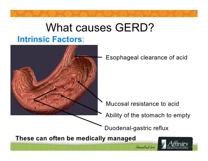 Heartburn and Acid Reflux: Causes 