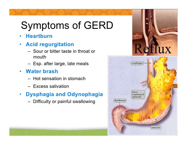 Heartburn and Acid Reflux: Causes 