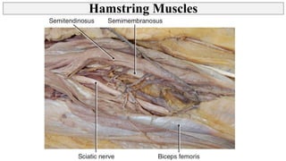 Thigh - Posterior Compartment, Hamstring muscles | PPT