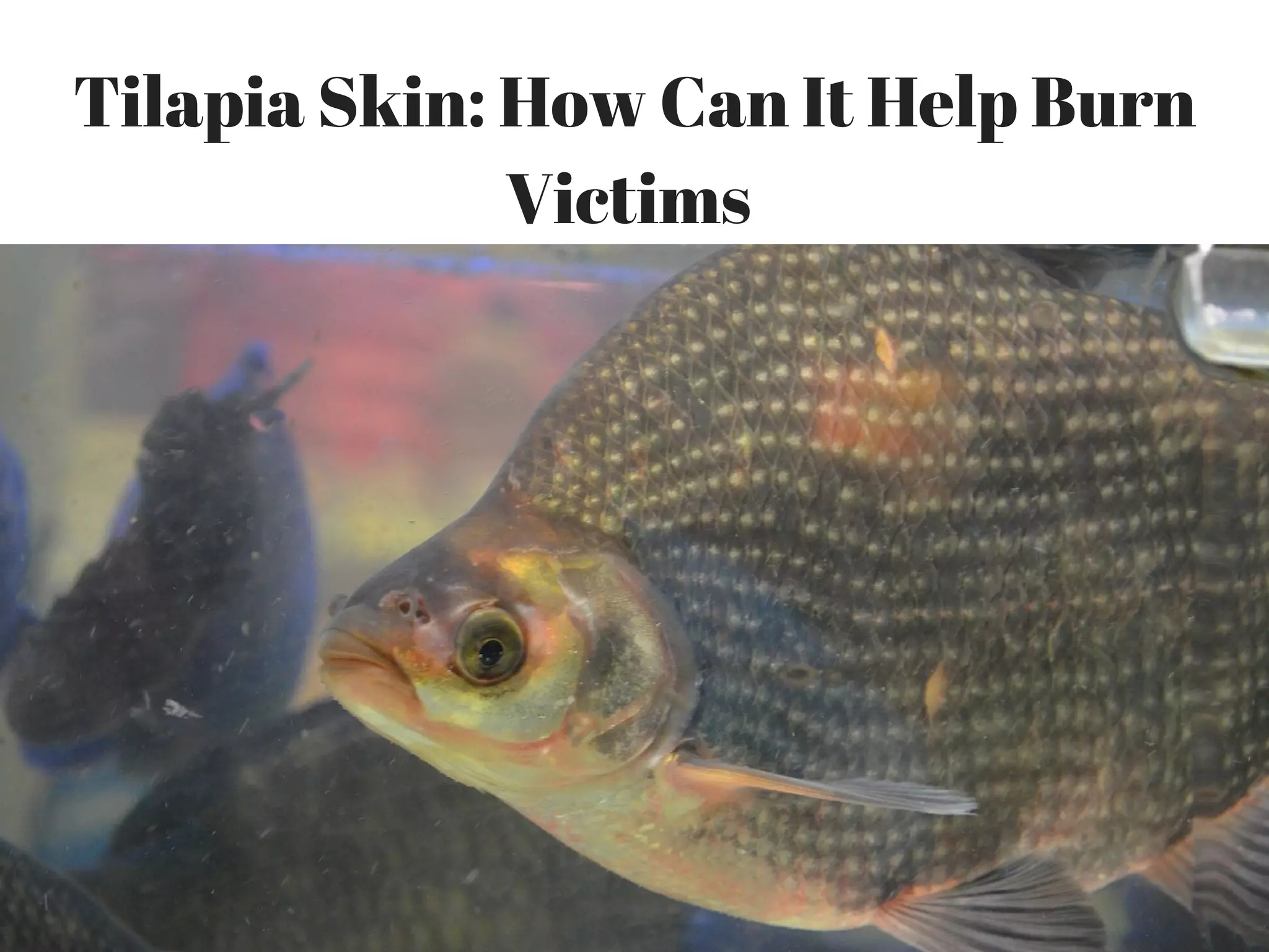 Tilapia Skin How Can It Help Burn Victims PPT