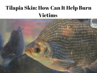 Tilapia Skin: How Can It Help Burn
Victims 
 