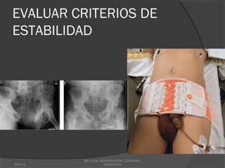 EVALUAR CRITERIOS DE
ESTABILIDAD
18/07/16
MG, HTAL MISERICORDIA, CORDOBA,
ARGENTINA
 