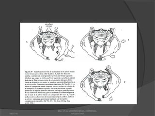 18/07/16
MG, HTAL MISERICORDIA, CORDOBA,
ARGENTINA
 