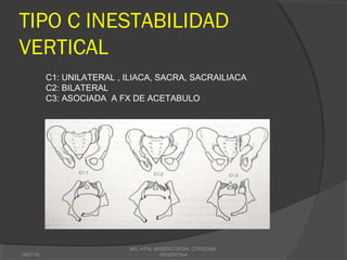 TIPO C INESTABILIDAD
VERTICAL
18/07/16
MG, HTAL MISERICORDIA, CORDOBA,
ARGENTINA
C1: UNILATERAL , ILIACA, SACRA, SACRAILIACA
C2: BILATERAL
C3: ASOCIADA A FX DE ACETABULO
 