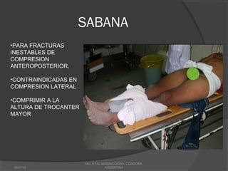 SABANA
18/07/16
MG, HTAL MISERICORDIA, CORDOBA,
ARGENTINA
•PARA FRACTURAS
INESTABLES DE
COMPRESION
ANTEROPOSTERIOR.
•CONTRAINDICADAS EN
COMPRESION LATERAL
•COMPRIMIR A LA
ALTURA DE TROCANTER
MAYOR
 