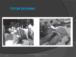 18/07/16
MG, HTAL MISERICORDIA, CORDOBA,
ARGENTINA
TUTOR EXTERNO
 