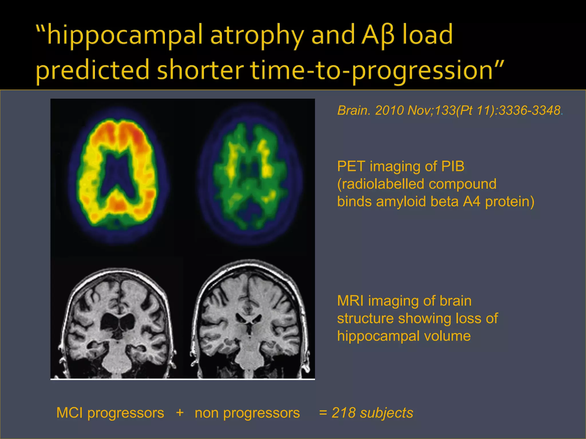 MCI progressors  non progressors  PET imaging of PIB (radiolabelled compound binds amyloid beta A4 protein) MRI imaging of brain structure showing loss of hippocampal volume Brain. 2010 Nov;133(Pt 11):3336-3348 .  = 218 subjects +  