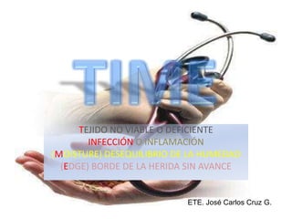 TIME TEJIDO NO VIABLE O DEFICIENTE INFECCIÓN O INFLAMACIÓN (MOISTURE) DESEQUILIBRIO DE LA HUMEDAD (EDGE) BORDE DE LA HERIDA SIN AVANCE ETE. José Carlos Cruz G. 