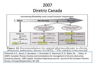 2007
Diretriz Canada
O’Donnell, D. E., Aaron, S., Bourbeau, J., Hernandez, P., Marciniuk, D. D., Balter, M., … Voduc, N.
(2007). Canadian Thoracic Society recommendations for management of chronic obstructive
pulmonary disease - 2007 update. Canadian Respiratory Journal : Journal of the Canadian Thoracic
Society, 14 Suppl B(September), 5B–32B.
 