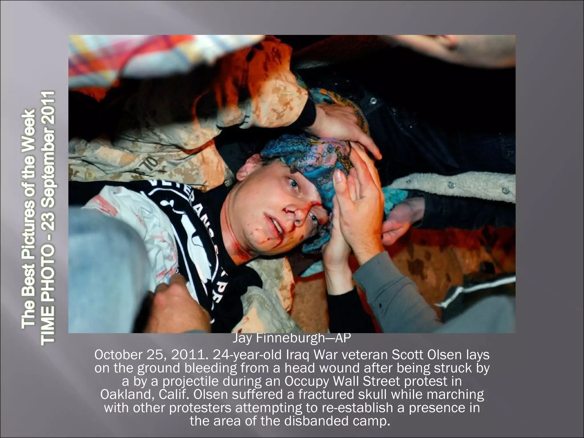 Jay Finneburgh—AP October 25, 2011. 24-year-old Iraq War veteran Scott Olsen lays on the ground bleeding from a head wound after being struck by a by a projectile during an Occupy Wall Street protest in Oakland, Calif. Olsen suffered a fractured skull while marching with other protesters attempting to re-establish a presence in the area of the disbanded camp.  