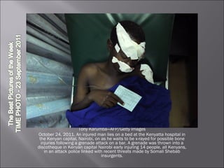 Tony Karumba—AFP/Getty Images October 24, 2011. An injured man lies on a bed at the Kenyatta hospital in the Kenyan capital, Nairobi, on as he waits to be x-rayed for possible bone injuries following a grenade attack on a bar. A grenade was thrown into a discotheque in Kenyan capital Nairobi early injuring 14 people, all Kenyans, in an attack police linked with recent threats made by Somali Shebab insurgents. 