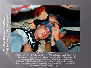 Jay Finneburgh—AP October 25, 2011. 24-year-old Iraq War veteran Scott Olsen lays on the ground bleeding from a head wound after being struck by a by a projectile during an Occupy Wall Street protest in Oakland, Calif. Olsen suffered a fractured skull while marching with other protesters attempting to re-establish a presence in the area of the disbanded camp.  