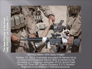 Behrouz Mehri—AFP/Getty Images October 31, 2011. A severely wounded US Marine hit by an Improvised Explosive Device (IED) is carried by his comrades to a medevac helicopter of U.S. Army's Task Force Lift "Dust Off", Charlie Company 1-171 Aviation Regiment to be airlifted in Helmand province.  