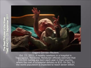 Edgard Garrido—Reuters Oct. 21, 2011. A healthy newborn in a hospital in Tegucigalpa, Honduras. Honduran officials estimate that 220,000 babies are born each year in their country, where the cost of a hospital delivery is $10. On Oct. 31 the world population is expected to reach seven billion. 