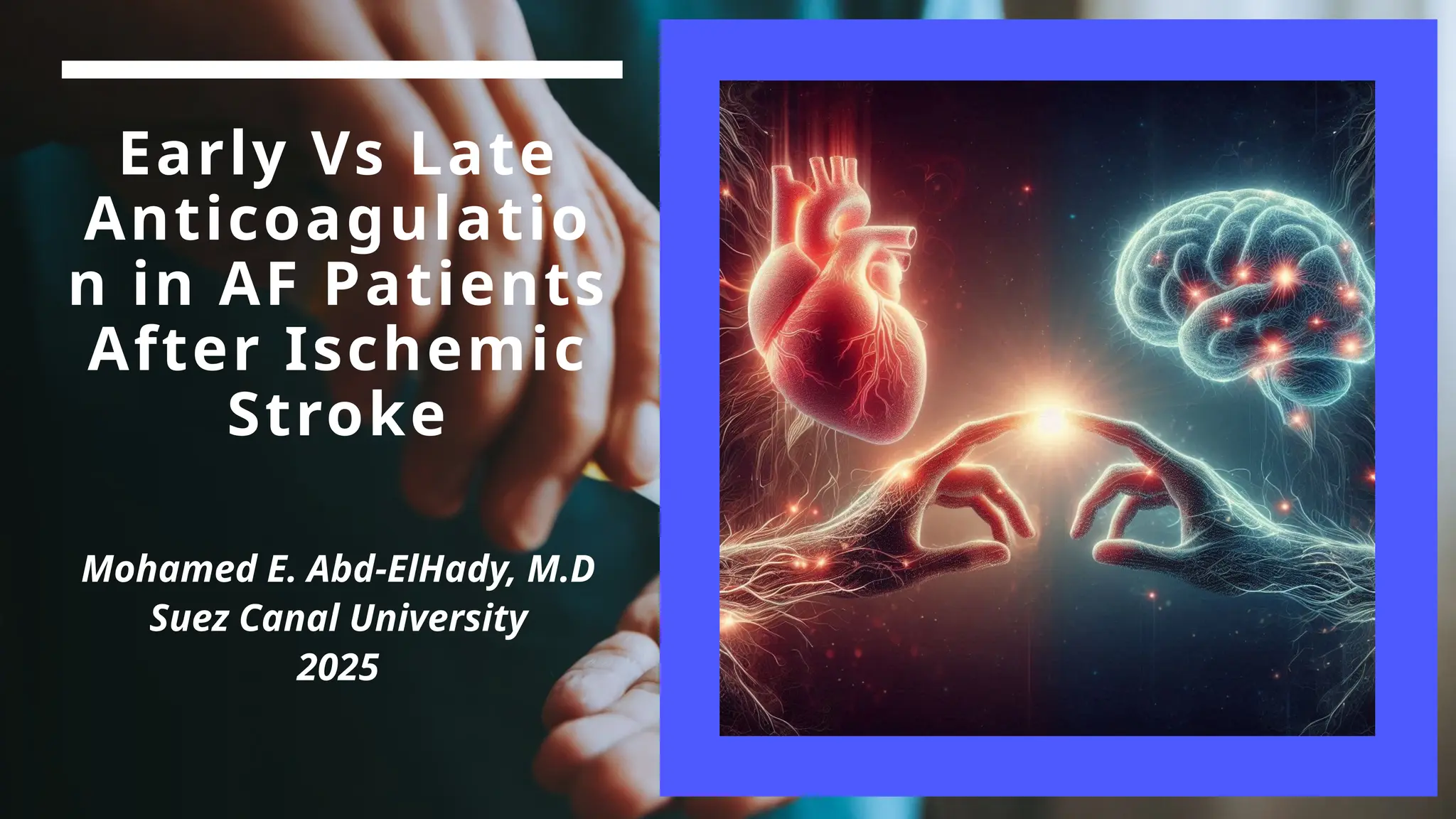 Timing of Oral Anticoagulation Initiation After Ischemic Stroke | PPTX
