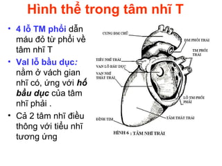 Hình thể trong tâm nhĩ T
• 4 lỗ TM phổi dẫn
máu đỏ từ phổi về
tâm nhĩ T
• Val lỗ bầu dục:
nằm ở vách gian
nhĩ có, ứng với hố
bầu dục của tâm
nhĩ phải .
• Cả 2 tâm nhĩ điều
thông với tiểu nhĩ
tương ứng
 
