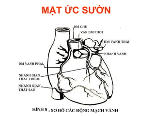 MẶT ỨC SƯỜN
 