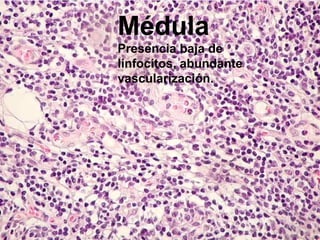 Médula
Presencia baja de
linfocitos, abundante
vascularización.
 