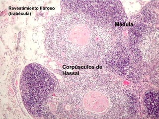 Corpúsculos de
Hassal
Revestimiento fibroso
(trabécula)
Médula
 