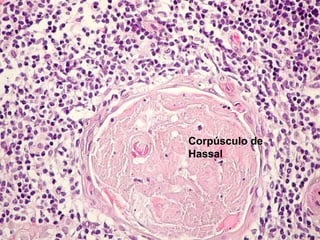 Corpúsculo de
Hassal
 