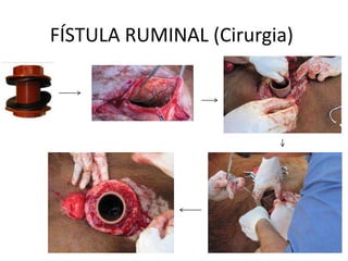 FÍSTULA RUMINAL (Cirurgia)
 