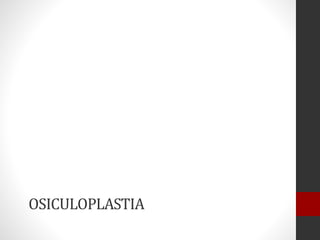 OSICULOPLASTIA
 