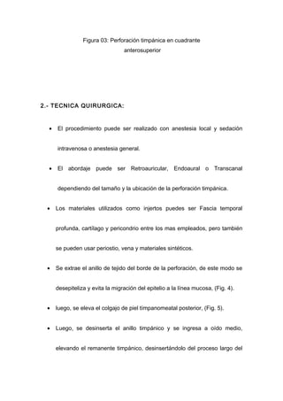 Figura 03: Perforación timpánica en cuadrante
                                  anterosuperior




2.- TECNICA QUIRURGICA:


  •   El procedimiento puede ser realizado con anestesia local y sedación


      intravenosa o anestesia general.


  •   El abordaje puede ser Retroauricular, Endoaural o Transcanal


      dependiendo del tamaño y la ubicación de la perforación timpánica.


 •    Los materiales utilizados como injertos puedes ser Fascia temporal


      profunda, cartílago y pericondrio entre los mas empleados, pero también


      se pueden usar periostio, vena y materiales sintéticos.


 •    Se extrae el anillo de tejido del borde de la perforación, de este modo se


      desepiteliza y evita la migración del epitelio a la línea mucosa, (Fig. 4).


 •    luego, se eleva el colgajo de piel tímpanomeatal posterior, (Fig. 5).


 •    Luego, se desinserta el anillo timpánico y se ingresa a oído medio,


      elevando el remanente timpánico, desinsertándolo del proceso largo del
 