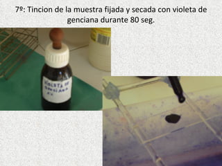 7º: Tincion de la muestra fijada y secada con violeta de genciana durante 80 seg.