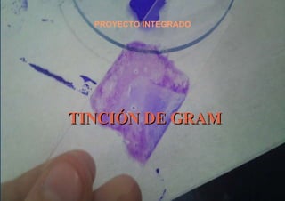 PROYECTO INTEGRADO TINCIÓN DE GRAM 