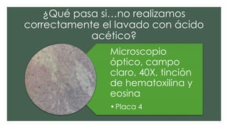 ¿Qué pasa si…no realizamos
correctamente el lavado con ácido
acético?
Microscopio
óptico, campo
claro, 40X, tinción
de hematoxilina y
eosina
•Placa 4
 