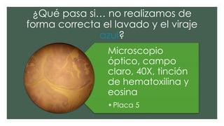 ¿Qué pasa si… no realizamos de
forma correcta el lavado y el viraje
azul?
Microscopio
óptico, campo
claro, 40X, tinción
de hematoxilina y
eosina
•Placa 5
 