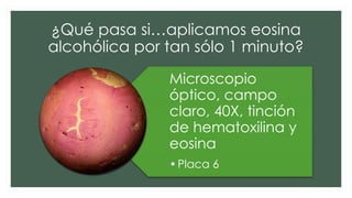 ¿Qué pasa si…aplicamos eosina
alcohólica por tan sólo 1 minuto?
Microscopio
óptico, campo
claro, 40X, tinción
de hematoxilina y
eosina
•Placa 6
 