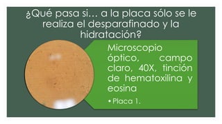 ¿Qué pasa si… a la placa sólo se le
realiza el desparafinado y la
hidratación?
Microscopio
óptico, campo
claro, 40X, tinción
de hematoxilina y
eosina
•Placa 1.
 