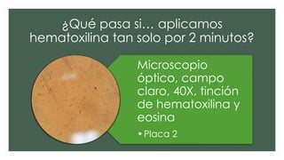 ¿Qué pasa si… aplicamos
hematoxilina tan solo por 2 minutos?
Microscopio
óptico, campo
claro, 40X, tinción
de hematoxilina y
eosina
•Placa 2
 