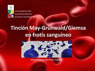 Universidad de Chile
 Facultad de Medicina
 Escuela de Tecnología Médica




Tinción May-Grünwald/Giemsa
      en frotis sanguíneo



                   Maximiliano Martínez Ilabaca
 