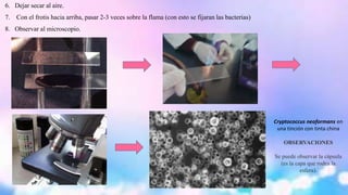 6. Dejar secar al aire. 
7. Con el frotis hacia arriba, pasar 2-3 veces sobre la flama (con esto se fijaran las bacterias) 
8. Observar al microscopio. 
Cryptococcus neoformans en 
una tinción con tinta china 
OBSERVACIONES 
Se puede observar la cápsula 
(es la capa que rodea la 
esfera). 
 