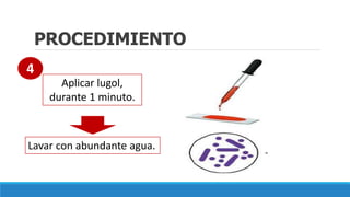 PROCEDIMIENTO
Aplicar lugol,
durante 1 minuto.
Lavar con abundante agua.
4
 