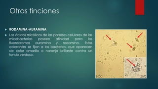 Otras tinciones


RODAMINA-AURAMINA



Los ácidos micólicos de las paredes celulares de las
micobacterias
poseen
afinidad
para
los
fluorocromos
auramina
y
rodamina.
Estos
colorantes se fijan a las bacterias, que aparecen
de color amarillo o naranja brillante contra un
fondo verdoso.

 