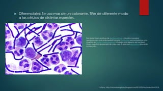 

Diferenciales: Se usa mas de un colorante. Tiñe de diferente modo
a las células de distintas especies.

Bacterias Gram positivas de Bacillus anthracis (bacilos morados)
que producen una enfermedad llamada Carbunco, encontrados en una
muestra de líquido cerebroespinal. Si hubiera una especia de bacteria
Gram negativa aparecería de color rosa. El resto son leucocitos atacando
la infección.

B.Fany. http://microbiologiavip.blogspot.mx/2012/02/tinciones.html 2013.

 
