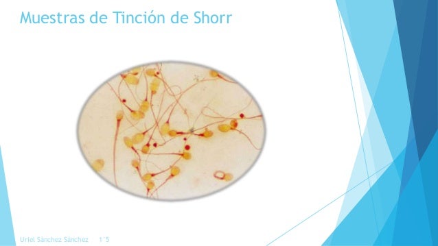 Tinciones de material citológico