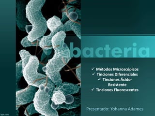  Métodos Microscópicos 
 Tinciones Diferenciales 
 Tinciones Ácido- 
Resistente 
 Tinciones Fluorescentes 
Presentado: Yohanna Adames 
 