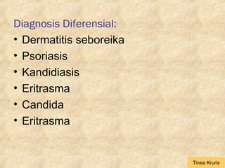 Diagnosis Diferensial:
• Dermatitis seboreika
• Psoriasis
• Kandidiasis
• Eritrasma
• Candida
• Eritrasma
Tinea Kruris
 
